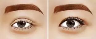 ��ҽ�����ա�С��Ů�ڲ�ͬ�������ȥ��˫��Ƥ������Ӧ����ôѡ��