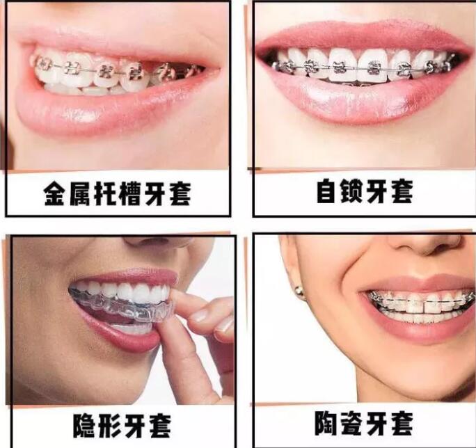 ����Ʒҽ�������ν�����������Щ����