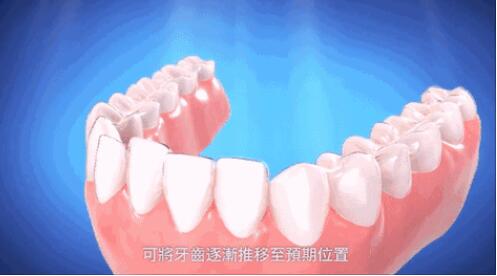 ����Ʒҽ�������ν�����������Щ����