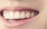 ��ҽ�����ա�Ů����Цû�и�Ⱦ�������벻���⼸��ԭ��