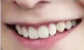 ��ҽ�����ա�Ů����Цû�и�Ⱦ�������벻���⼸��ԭ��