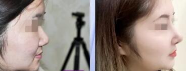 ����Ʒҽ������ɯ����Ů�����������쾡��