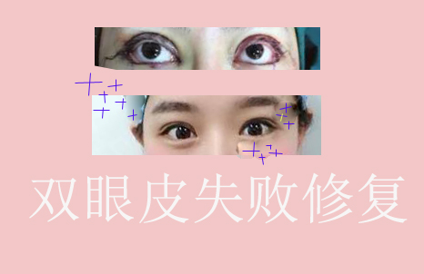 ˫��Ƥʧ���޸���Խ��Խ����