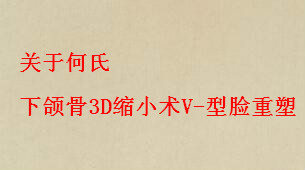 �ν�������3D��С��V-�������� ����������ƿư����