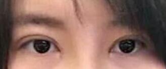 ˫��Ƥ�����������ľ����˺ܶ�