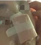 ¡��+����֬������������30�죬ҽ���ļ�����ĺܰ�