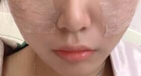 ����֬��ȫ��������ҵ�Ƥ���ۻ��ۻ���