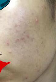 ע�䲣����ע��7���Ƥ��ˮˮ����