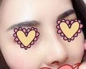 ������ҽ��¡�ǰ��� 30��ǰ��Ա�ͼ����