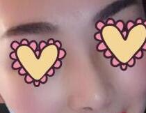 ������ҽ��¡�ǰ��� 30��ǰ��Ա�ͼ����