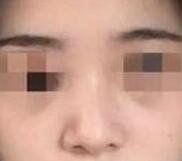 ����С���ﻨ1����ʱ����¡����������ô��仯