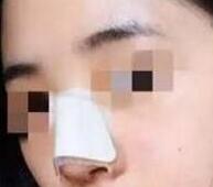 ����С���ﻨ1����ʱ����¡����������ô��仯