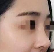 ����С���ﻨ1����ʱ����¡����������ô��仯