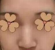 ¡�ǰ�������ɳ�����﷼��¡��Ч���Լ�����