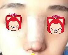 ¡�ǰ�������ɳ�����﷼��¡��Ч���Լ�����