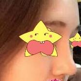 ¡�ǰ�������ɳ�����﷼��¡��Ч���Լ�����