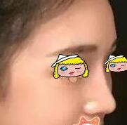 ¡�ǰ�������ɳ�����﷼��¡��Ч���Լ�����