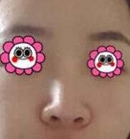 ¡������25��󣬱��ӱ仯�ô�