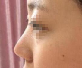 ¡�ǰ�����Ч��������