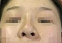 ¡�ǰ���������¡��Ч������