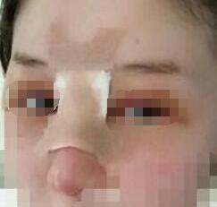 ¡�ǰ���������¡��Ч������