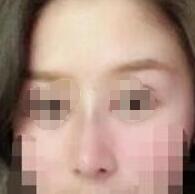 ¡�ǰ���������¡��Ч������