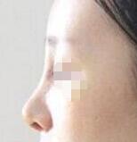 �������һ���£���¡��ʧ���޸������ǵ�ѡ��