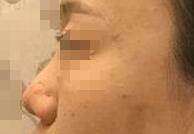 ������¡�ǰ����������ջ�������