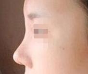 ������¡�ǰ����������ջ�������