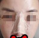 ¡ʧ޸7죬֮ǰö