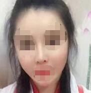 隆鼻+瘦脸+玻尿酸注射案例：我就是一个穿越古今的奇女子