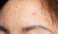 �����۷������º󣬼�����ͬӤ����ˮ�۹⻬