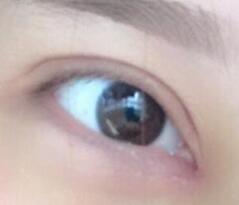 �����۽ǰ��������ڰ����˸���27���С�۾�