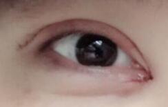 �����۽ǰ��������ڰ����˸���27���С�۾�