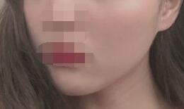 ���󼤹��ӡ���������и��װ׾�������