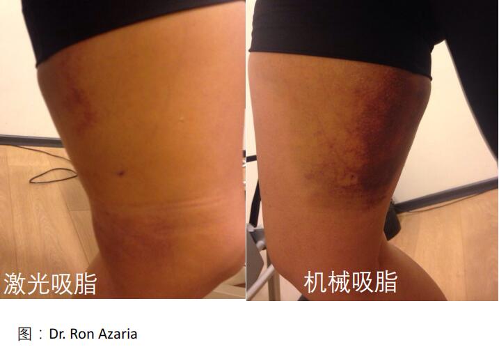 ��һ����������֣�ݻ����������� �ͽ�5G��ʹ���