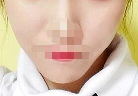 ������ȸ���������û���뵽Ƥ����ָ�����ô��