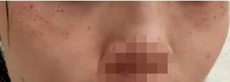 �����������ӵ������ô�õļ���״̬